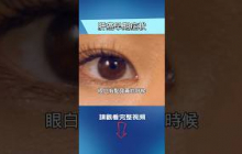 肝癌一發現就是晚期？其實身體早就提示你了！