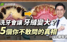 為什麼洗牙害牙縫變大、牙齒酸軟？牙齒會變白嗎？牙醫師破解5大洗牙迷思 ∣ 康智為 牙科醫師【早安健康 × 健康大頭條】