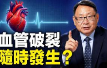 動脈血管破裂前看似沒事，但卻有生命危險！保護血管可以預防症狀