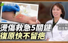 燙傷塗蘆薈、冰敷救急？外科醫手把手教你「正確照護」，復原快不留疤｜游佳靜 一般外科醫師 【早安健康 × 健康大頭條】