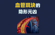 血管斑块的隐形元凶